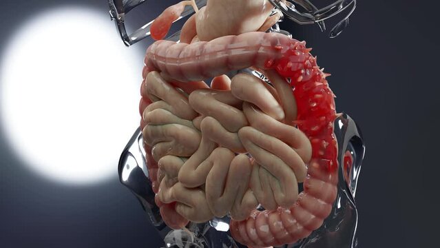 Anatomy of the human digestive system, concept of the intestine, diverticulitis, 3d render