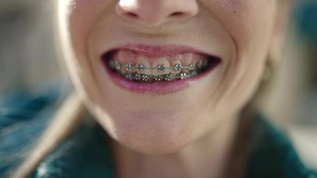 Young blonde woman smiling confident showing braces at street
