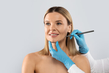 Plastic surgeon drawing contours around female chin before surgery