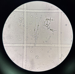 Budding yeast cell with pseudo hyphae.