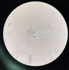 Budding yeast cell with pseudo hyphae.