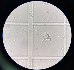 Budding yeast cell with pseudo hyphae.
