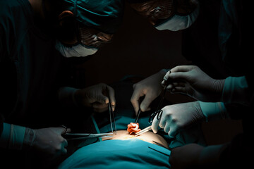 Surgical team performing surgery to patient in sterile operating room. In a surgery room lit by a...