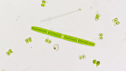 Freshwater green algae called Penium sp (green long algae) and Staurastrum sp. (small one)....