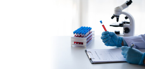 Close up view of lab technician assistant analyzing a blood sample in test tube at laboratory with microscope. Medical, pharmaceutical and scientific research and development concept.