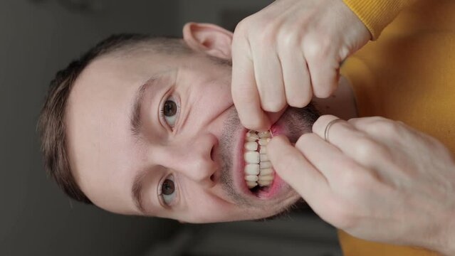 Vertical video. Young man pulls orthodontic rubber band on his teeth to correct his bite. Dental concept. Isolated