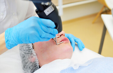 cosmetologist uses a CO2 fractional ablative laser to rejuvenate the skin and remove scars in a...