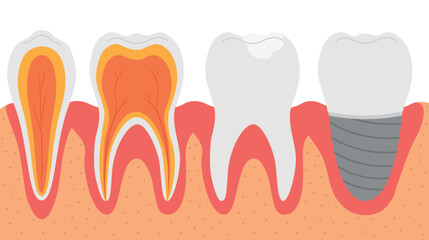 Diverse types of teeth, vector illustration