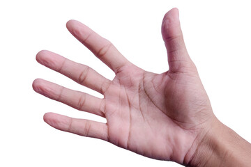 hands wrinkled from cold or too long exposure to water
