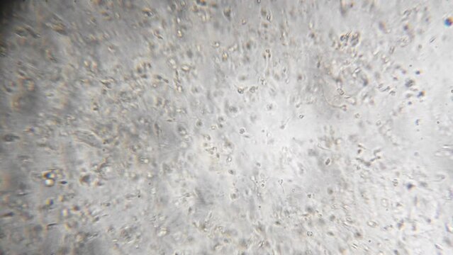 Slow motion filming of the movement of active spermatozoa under a microscope. Sperm bank. reproductive function of man. The survival of all mankind