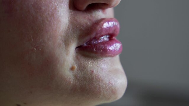 Close up shot of lips of young beauutiful wpman after botox injection. Extreme close up 4k shot