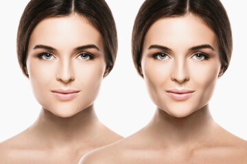 Female face comparison after buccal fat extraction plastic surgery