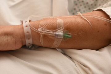 catheter needles in a patient's arm