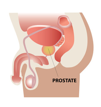 Prostate - Pr&oacute;stata