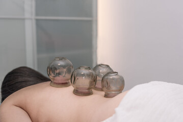 Traditional Chinese medicine acupuncture cupping therapy treatment for pain reliever at back by...