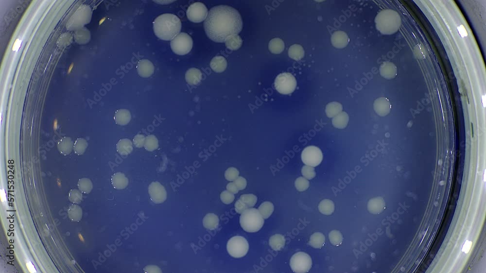 Poster Petri dish with bacterial samples from the surface of human skin