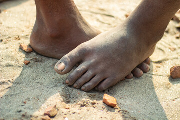 One man's feet in the sand on top of another man's feet and the background behind them is blurred