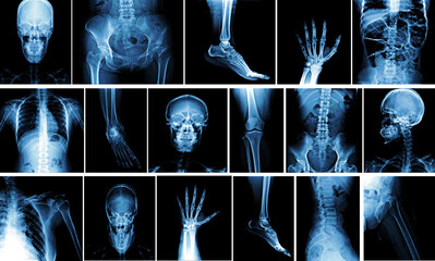 Many x-ray images of very good quality. - obrazy, fototapety, plakaty
