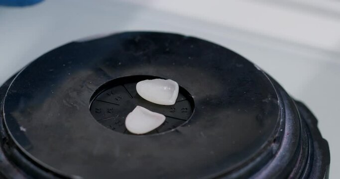 Close-up, ceramic onlays for the teeth of a patient of a dental clinic on a plastic table, ceramic blanks for the front teeth. Minimally invasive porcelain veneers