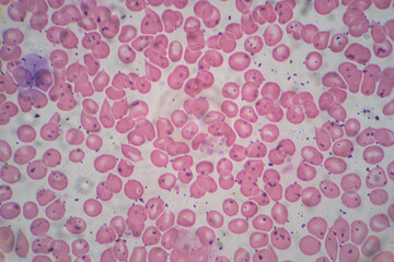 Human blood cells, Blood group and white blood cell study under microscopic.