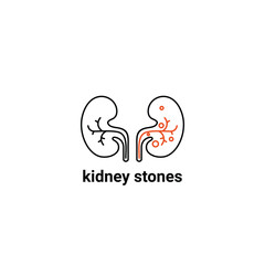 Human organ symbol, kidney stones problem. Modern vector line icons of urology. Linear medical pictogram for clinic, hospital. 