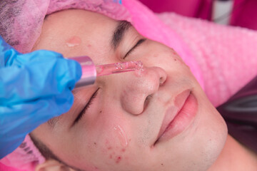 An Esthetician applies Diamond serum to the face of a patient. Facial rejuvenation procedure at a dermatology or aesthetic clinic.
