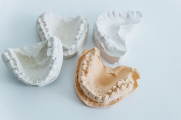 A cast of teeth. Plaster model of plaster of teeth. Dental plaster cast, casts of human jaws and teeth. Close-up on a white background