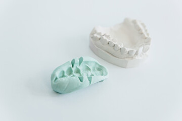 A cast of teeth. Plaster model of plaster of teeth. Dental plaster cast, casts of human jaws and teeth. Close-up on a white background