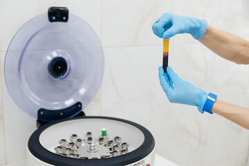 Tube with blood in hands. Centrifuge. Background