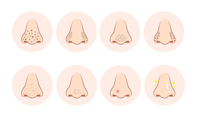 skin pores on human nose illustration. Isolated on white background.