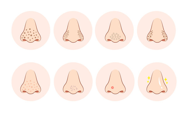 skin pores on human nose illustration. Isolated on white background.