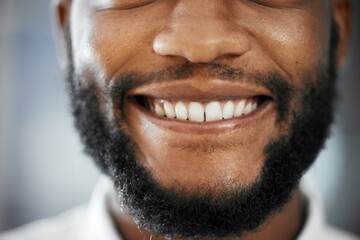 Fototapeta premium Cropped closeup, black man and smile with teeth, happiness and excited for dental healthcare. Macro headshot, healthy mouth and oral hygiene by blurred background for medical cleaning, goal and ideas