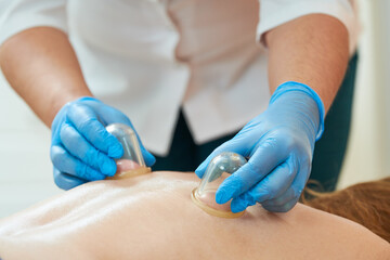 Physical cupping therapy. Doctor performing massage on human body with plastic cups