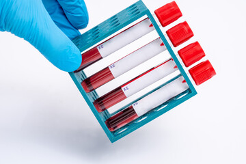 rack with test tubes of blood samples for biochemical analysis in a medical laboratory