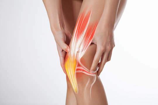 Knee meniscus inflamed, human leg, medically accurate representation of an arthritic knee joint	
