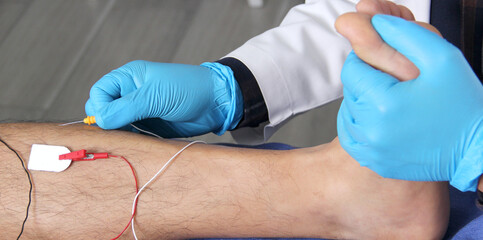 Electromyography in the lower limbs, graphic recording technique of the electrical activity...
