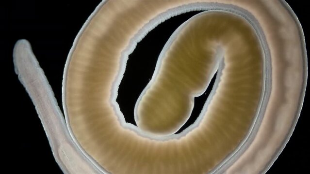 Nemertea worm Cephalothrix linearis under a microscope, class Palaeonemertea, order Archinemertea. The specimen was found in Barents Sea.
