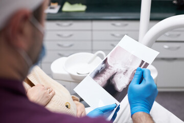 Focus on dental x-ray panoramic radiography in dentist's hand . Medicine and dental health. Dentistry