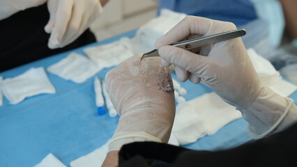 teamwork of doctors during surgery. doctors during surgery
