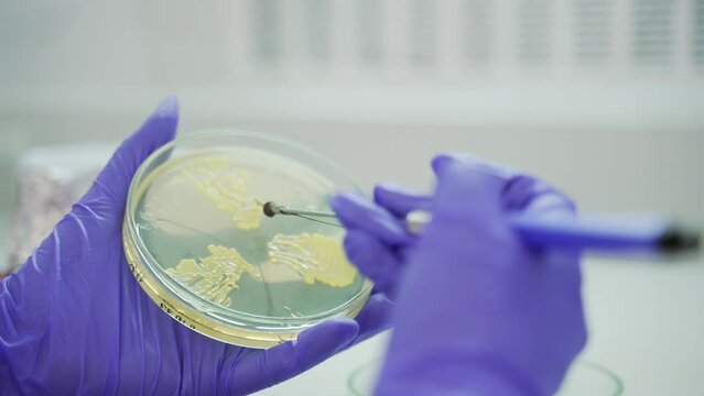 Close up hands of scientist working with different shaped colonies of bacteria yeast and mold growing on agar plates from environmental samples at microbiology pharmaceutical biochemistry laboratory