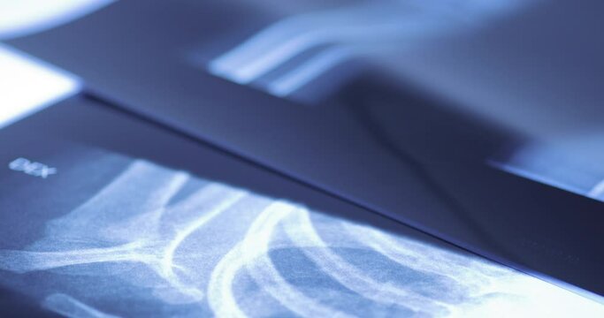 Closeup of different x-ray images on the table