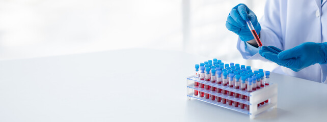 Lab assistant, a medical scientist, a chemistry researcher holds a glass tube through the blood sample, does a chemical experiment and examines a patient's blood sample. Medicine and research concept.