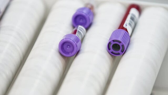 Close up shot of blood samples being agitated on centrifuge. Blurred background. High quality 4k footage