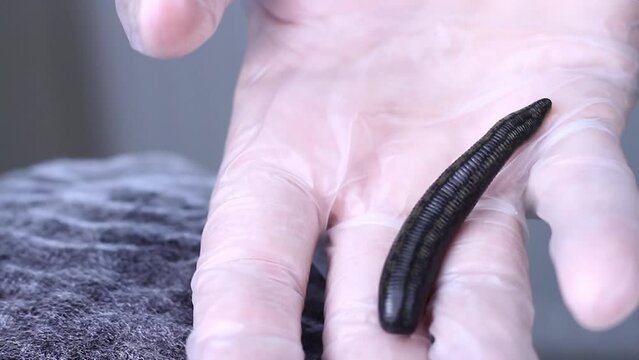A medical leech full of blood lies on the palm of hand, wearing a glove. High quality FullHD footage