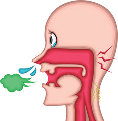 アレルギー　風邪　イラスト