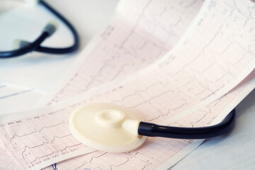 The concept of heart diseases and heart attack prevention. Cardiogram with stethoscope on table,...