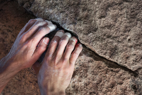 Closeup of a taped up, bloody climber's hands grabbing a granite hold.