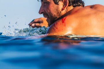Surfer in ocean with blood on shoulder, Lakey Peak, central Sumbawa, Indonesia