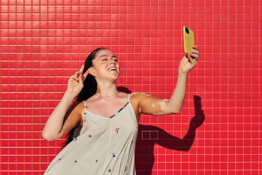Woman with vitiligo smiling while taking selfies with a mobile phone outdoors.