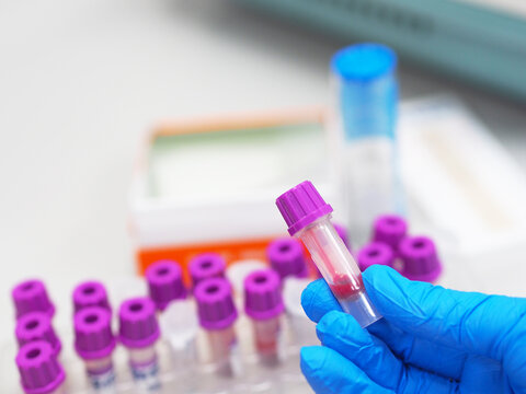 EDTA Blood sample for Complete blood cell count(CBC) testing. Hand in gloves holding blood test tube on  lab room background.
